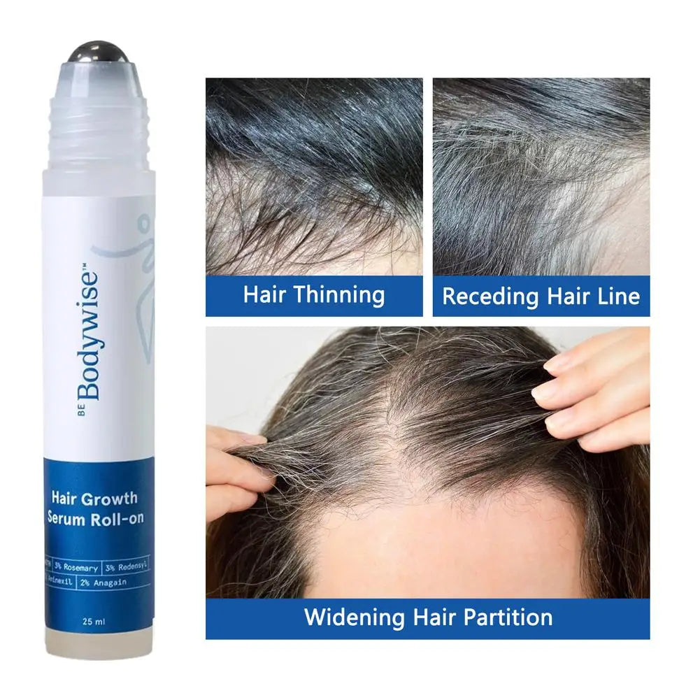 25ml Hair Growth Essence Oil for Hair Care, Scalp Nourishment & Frizz Control 3% Rosemary Hair Serum