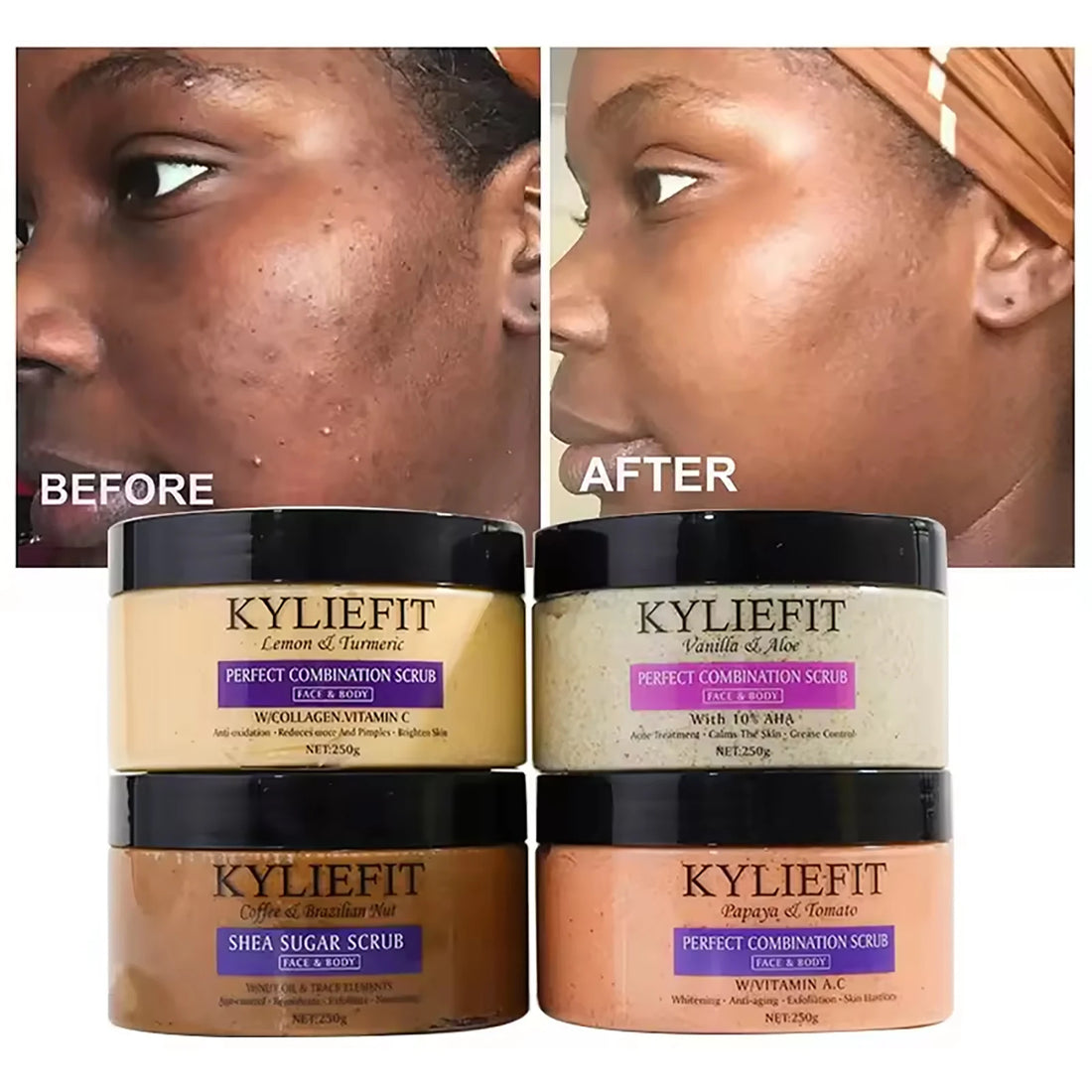 Exfoliating Face & Body Scrub  – Smooth Skin Polish