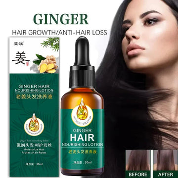 Hair Growth Serum Fast Growing Hair Essential Oil Beauty Hair Care 30ml Dense Regrowth Ginger Hair Promoting Regeneration