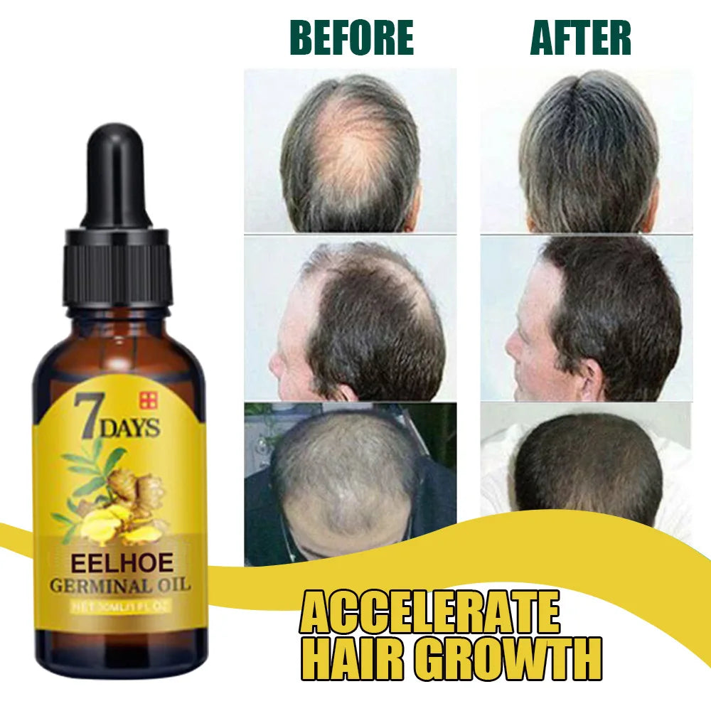 EELHOE Ginger Hair Growth Oil for Scalp Massage Hair Follicle Treatment Hair Care Germinal Essence for Regrowth & Loss Treatment