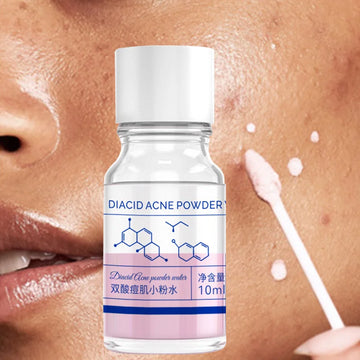 10ml pink salicylic acid concentrated acne essence - containing salicylic acid, lactose acid, calamine, double acid dual care, s