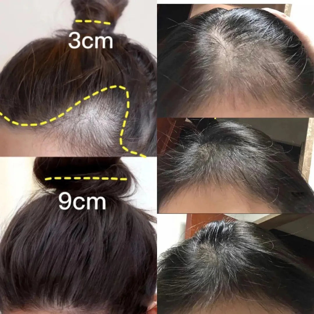 Ginger Hair Growth Essential Oil Anti-loss Hair Treatment Hair Regrowth Oil Fast Hair Promoting Regeneration Hair Care Women Men