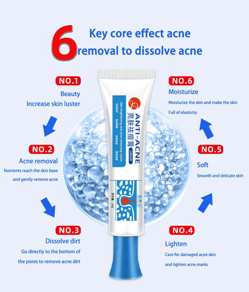 Anti-acne Treatment Cream Salicylic Acid Acne Deep Cleaning Pore Repair Pimple Spots Shrinking Oil Control Moisturizer Skin Care