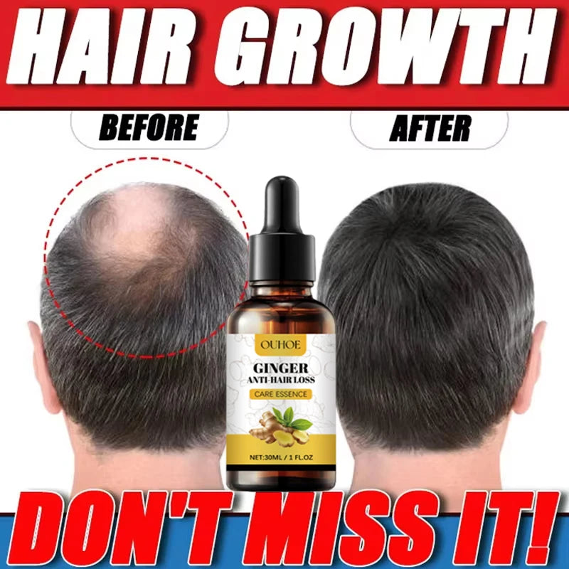Ginger Hair Growth Essential Oil Anti-loss Hair Treatment Hair Regrowth Oil Fast Hair Promoting Regeneration Hair Care Women Men