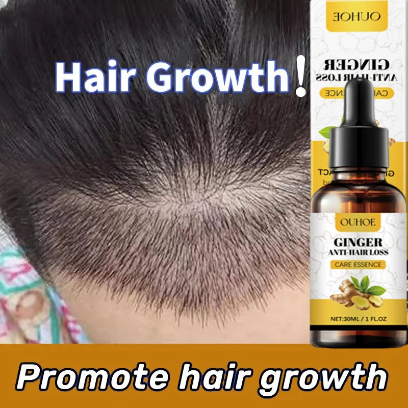 Ginger Hair Growth Essential Oil Anti-loss Hair Treatment Hair Regrowth Oil Fast Hair Promoting Regeneration Hair Care Women Men