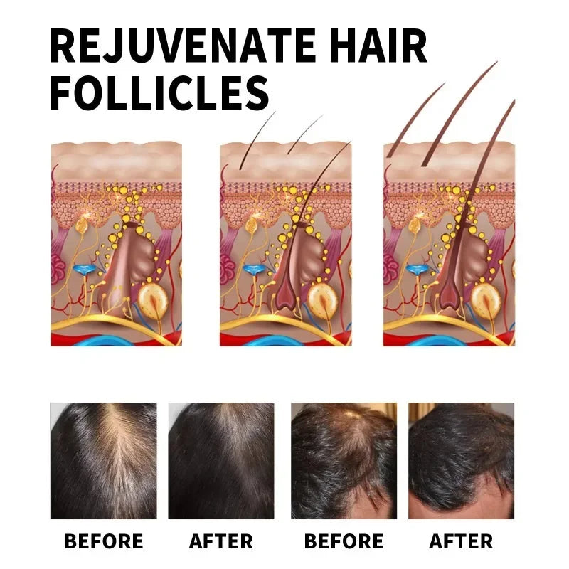 Hair Growth Serum Fast Growing Hair Essential Oil Beauty Hair Care 30ml Dense Regrowth Ginger Hair Promoting Regeneration